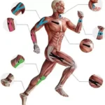 Kinesio tape